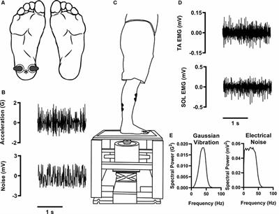 Subthreshold Electrical Noise Applied to the Plantar Foot Enhances Lower-Limb Cutaneous Reflex Generation